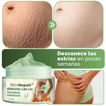 Piel Perfecta – Crema Antiestrías para Todo Tipo de Piel