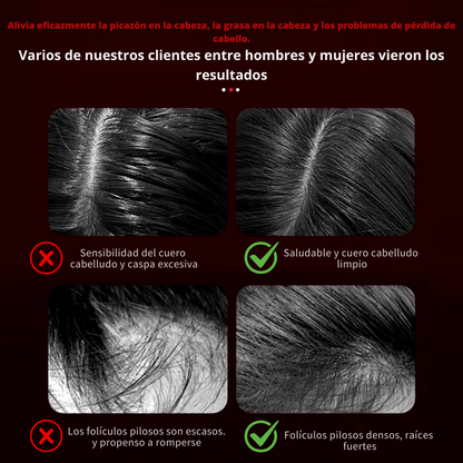 Hair & Beard Revive - Peine de masaje + Regalo suero para barba gratis