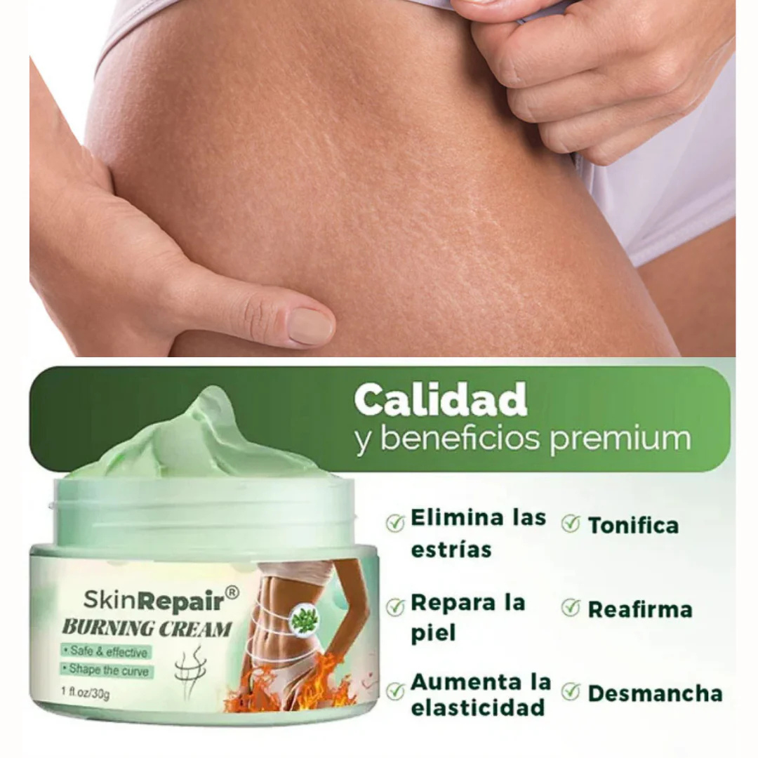 Piel Perfecta – Crema Antiestrías para Todo Tipo de Piel